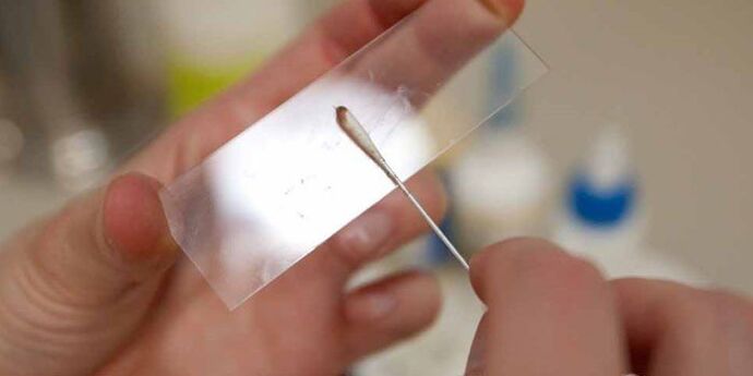 Ξύσιμο του δέρματος για παράσιτα