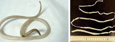 Τύποι παρασίτων στο ανθρώπινο σώμα